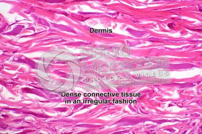 Man. Skin and epidermis. Vertical section. 250X
