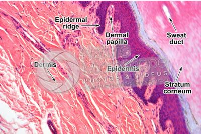 Man. Skin and epidermis. Vertical section. 100X