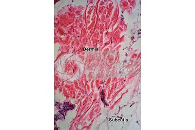 Man. Skin and epidermis. Vertical section. 125X