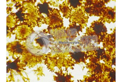 Man. Melanocytes. 100X