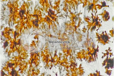 Man. Melanocytes. 100X