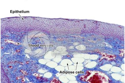 Mammal. Esophagus. Transverse section. 100X