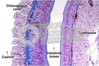 Lumbricus sp. Earthworm. Lumbricidae. Transverse section. 250X