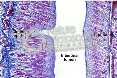 Lumbricus sp. Earthworm. Lumbricidae. Transverse section. 500X