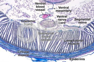Lumbricus sp. Earthworm. Lumbricidae. Transverse section. 125X