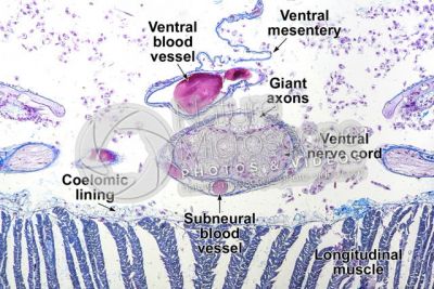 Lumbricus sp. Earthworm. Lumbricidae. Transverse section. 250X