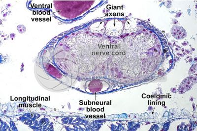 Lumbricus sp. Earthworm. Lumbricidae. Transverse section. 500X