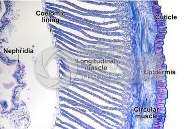 Lumbricus sp. Earthworm. Lumbricidae. Transverse section. 125X