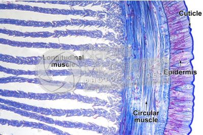 Lumbricus sp. Earthworm. Lumbricidae. Transverse section. 250X
