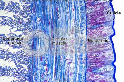 Lumbricus sp. Earthworm. Lumbricidae. Transverse section. 500X