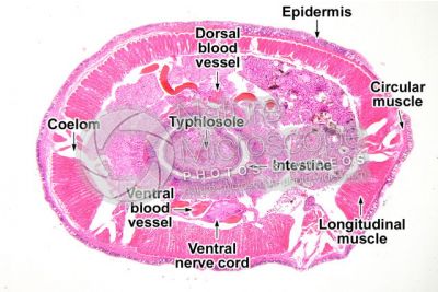 Lumbricus sp. Earthworm. Lumbricidae. Transverse section. 32X