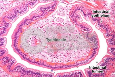 Lumbricus sp. Earthworm. Lumbricidae. Transverse section. 125X