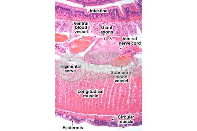 Lumbricus sp. Earthworm. Lumbricidae. Transverse section. 250X