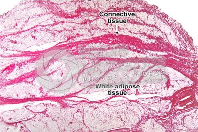 Mammal. Unilocular adipose tissue. Transverse section. 32X