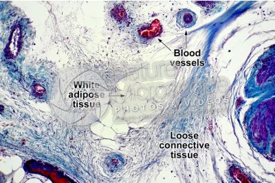 Mammal. Unilocular adipose tissue. Transverse section. 125X