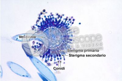 Aspergillus sp. Muffa. Fungo saprofita. Conidioforo. 400X