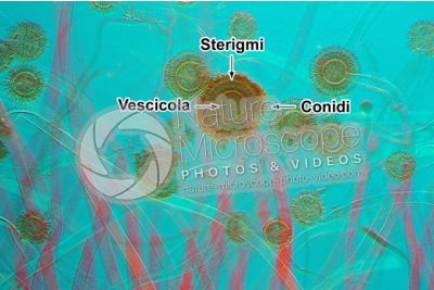 Aspergillus sp. Muffa. Fungo saprofita. Conidioforo. Colorazione di contrasto. 125X
