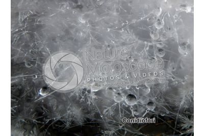 Aspergillus sp. Muffa. Fungo saprofita. 64X