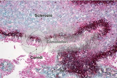 Claviceps purpurea. Ergot. Fungo parassita. Sezione longitudinale. 250X
