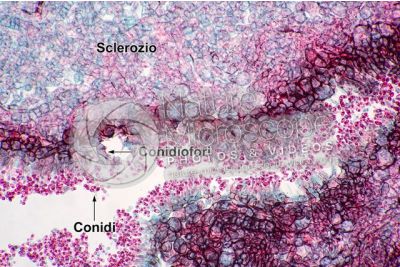 Claviceps purpurea. Ergot. Fungo parassita. Sezione longitudinale. 500X