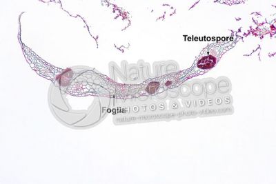 Ustilago tritici. Carbone del frumento. Fungo parassita. Sezione trasversale. 64X