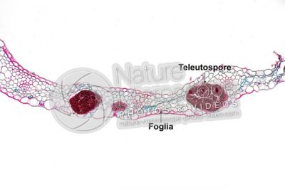 Ustilago tritici. Carbone del frumento. Fungo parassita. Sezione trasversale. 125X