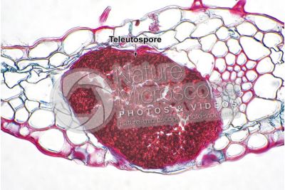 Ustilago tritici. Carbone del frumento. Fungo parassita. Sezione trasversale. 500X