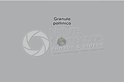 Solanum dulcamara. Morella rampicante. Polline. Visione polare. Colorazione di contrasto. 1000X