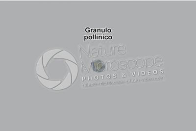 Solanum dulcamara. Morella rampicante. Polline. Visione equatoriale. Colorazione di contrasto. 1000X