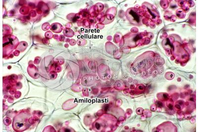 Solanum tuberosum. Patata. Tubero. Amido. 250X
