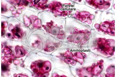 Solanum tuberosum. Patata. Tubero. Amido. 250X