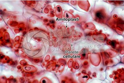 Solanum tuberosum. Patata. Tubero. Amido. 250X