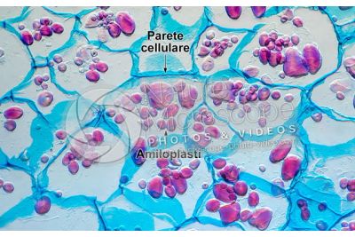 Solanum tuberosum. Patata. Tubero. Amido. 250X