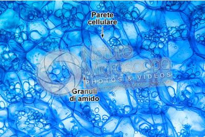 Solanum tuberosum. Patata. Cellule poliedriche. Colorazione con blu di metilene. 125X