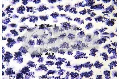 Solanum tuberosum. Patata. Tubero. Amido. Colorazione con tintura di iodio. 64X