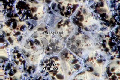 Solanum tuberosum. Patata. Tubero. Amido. Colorazione con tintura di iodio. 250X