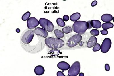 Solanum tuberosum. Patata. Tubero. Amido. Colorazione con tintura di iodio. 250X