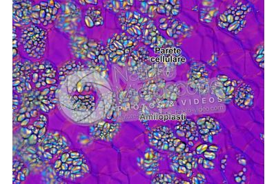 Solanum tuberosum. Patata. Tubero. Amido. Luce polarizzata. 125X