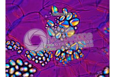 Solanum tuberosum. Patata. Tubero. Amido. Luce polarizzata. 250X