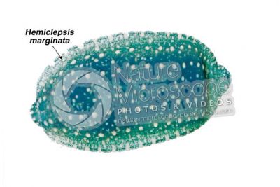 Hemiclepsis marginata. Leech