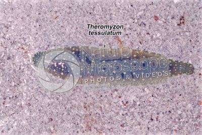 Theromyzon tessulatum. Leech
