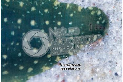 Theromyzon tessulatum. Leech