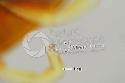 Argas reflexus. Pigeon tick. Ventral view. 20X