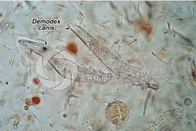 Demodex canis. Demodectic mange. 100X