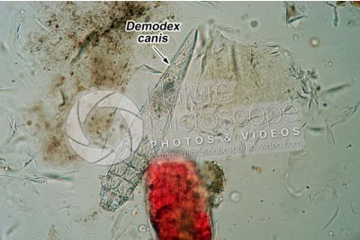 Demodex canis. Demodectic mange. 100X