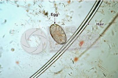 Demodex canis. Demodectic mange. 100X