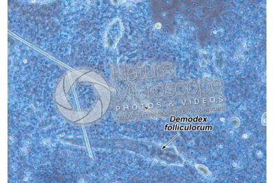 Demodex folliculorum. Demodectic mange. 100X