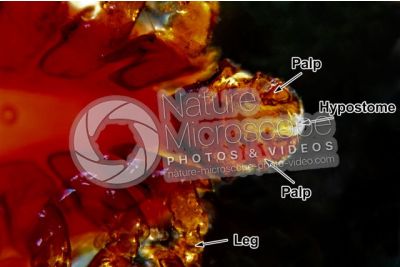 Ixodes ricinus. Castor bean tick. Ventral view. 25X