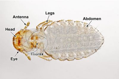 Damalinia equi. Biting louse. Ventral view