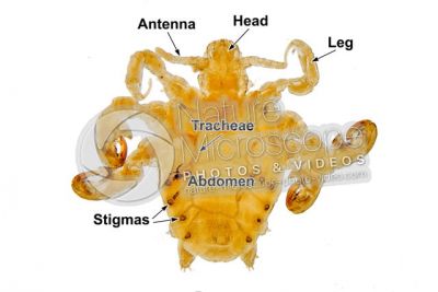 Pthirus pubis. Crab louse. Pediculosis pubis. Dorsal view